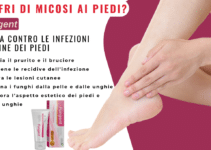 FUNGENT: LA CREMA CHE TI LIBERA DAI FUNGHI AI PIEDI IN MODO NATURALE E VELOCE!