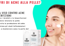 Revamin Acne Cream: la crema naturale che ti libera dall’acne