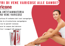 Varicone: la soluzione definitiva per le vene varicose