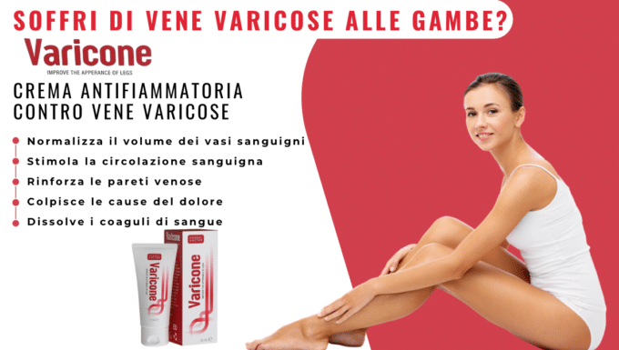 Varicone: la soluzione definitiva per le vene varicose