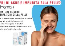 Zinamax: il tuo alleato contro l’acne!